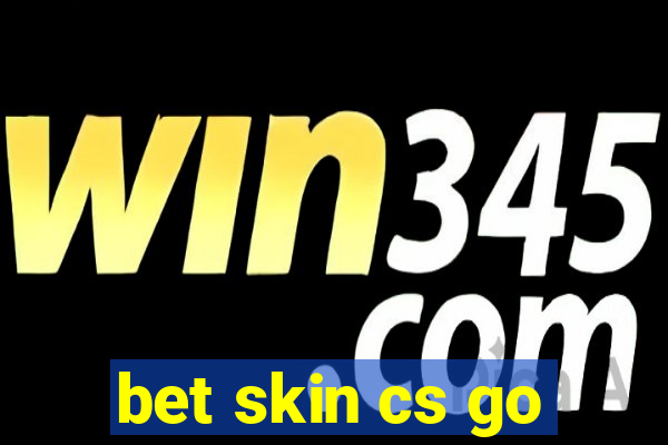 bet skin cs go