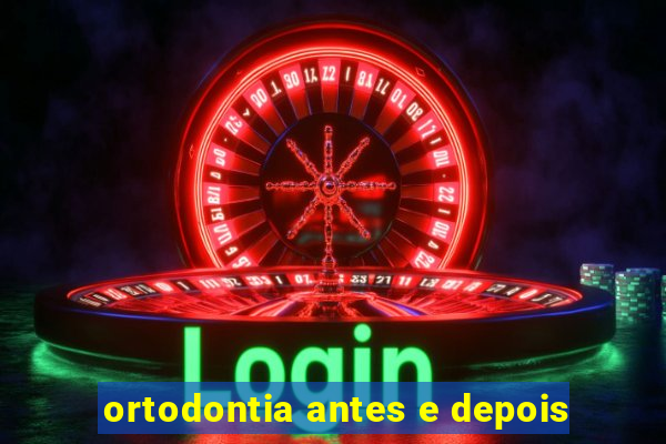 ortodontia antes e depois